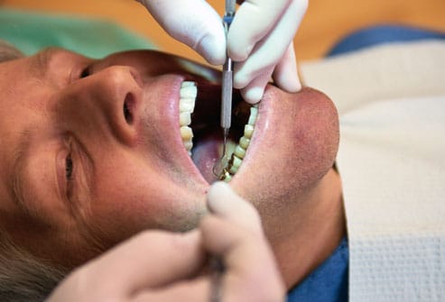 سفید کردن دندان دندانپزشک