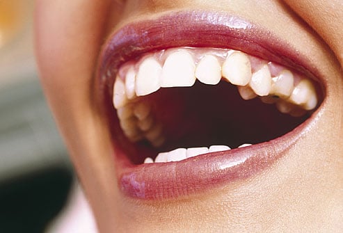 دندان سفید براق
